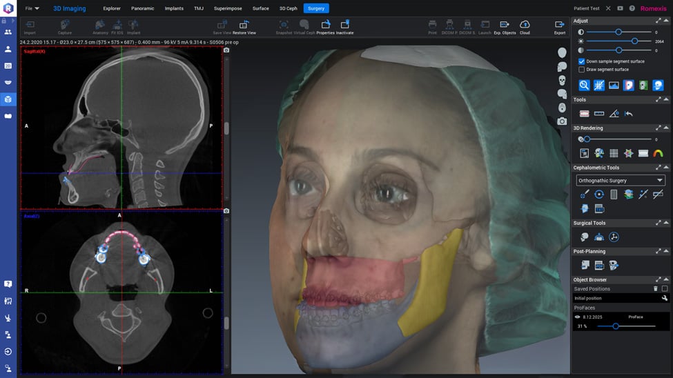 Romexis CMF Surgery 본사 제품 이미지