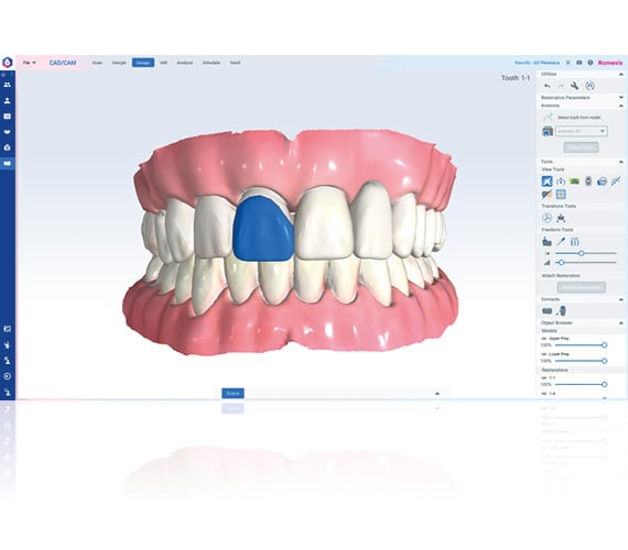 Romexis CAD/CAM 수복물 설계 본사 제품 이미지