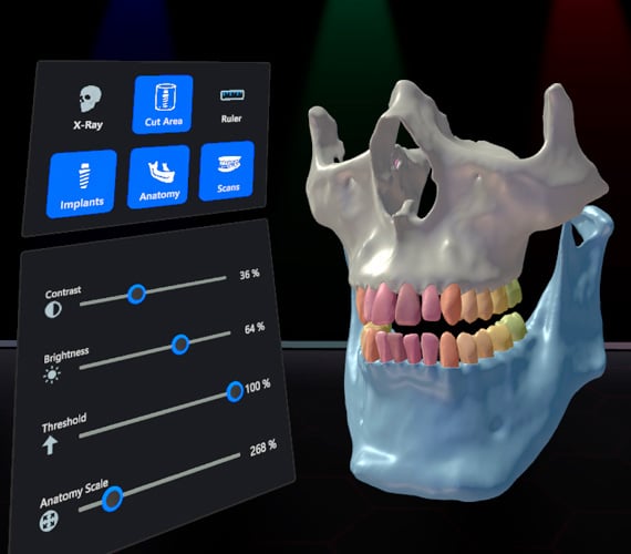 Romexis VR 본사 제품 이미지